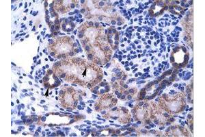 Image no. 1 for anti-Zinc Finger Protein 84 (ZNF84) (C-Term) antibody (ABIN202890) (ZNF84 anticorps  (C-Term))