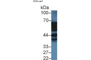 Detection of ANXA11 in Human A431 cell lysate using Polyclonal Antibody to Annexin A11 (ANXA11)