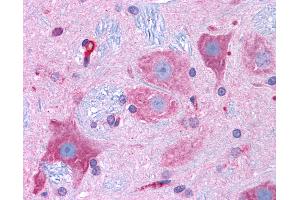 Anti-CACNA1D / Cav1.