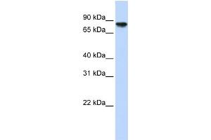WB Suggested Anti-GYS2 Antibody Titration:  0. (Glycogen Synthase 2 anticorps  (Middle Region))