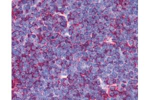 Anti-MAP3K7 / TAK1 antibody IHC of human thymus.