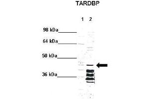 WB Suggested Anti-TARDBP Antibody  Positive Control: Lane 1: 5ug mouse brain cytoplasm Lane 2: 5ug mouse brain nucleus  Primary Antibody Dilution :  1:1000 Secondary Antibody : Anti rabbit - IR-dye Secondry Antibody Dilution :  1:10,000  Submitted by: Anonymous (TARDBP anticorps  (N-Term))