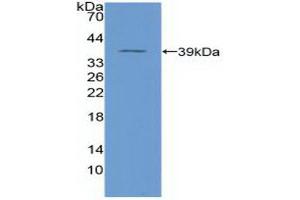 Detection of Recombinant NFkB, Human using Polyclonal Antibody to Nuclear Factor Kappa B (NFkB)