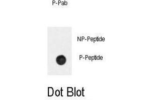 Dot blot analysis of anti-Phospho-BAR2-p Antibody (ABIN389931 and ABIN2839749) on nitrocellulose membrane. (BAR2 anticorps  (pSer261))