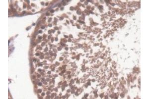 Detection of CAMK2a in Rat Testis Tissue using Polyclonal Antibody to Calcium/Calmodulin Dependent Protein Kinase II Alpha (CAMK2a)