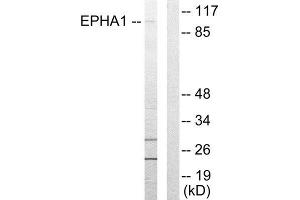 Western Blotting (WB) image for anti-Ephrin Type A Receptor 1 (EPHA1) (Internal Region) antibody (ABIN1849247) (EPHA1 anticorps  (Internal Region))