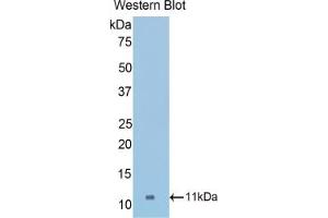 Western blot analysis of the recombinant protein. (COL2A1 anticorps  (AA 1307-1383))