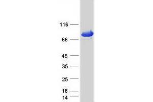 Validation with Western Blot