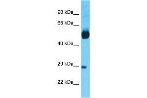 Host:  Rabbit  Target Name:  NR1H4  Sample Tissue:  Human Lung Tumor  Antibody Dilution:  1ug/ml