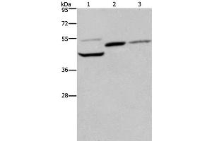 Western Blot analysis of Mouse heart, kidney and liver tissue using CYR61 Polyclonal Antibody at dilution of 1:350 (CYR61 anticorps)