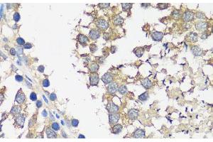 Immunohistochemistry of paraffin-embedded Rat testis using ASZ1 Polyclonal Antibody at dilution of 1:100 (40x lens). (ASZ1 anticorps)