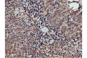 Immunohistochemistry (IHC) image for anti-V-Akt Murine Thymoma Viral Oncogene Homolog 1 (AKT1) antibody (ABIN1496555)
