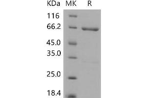 Western Blotting (WB) image for Mitogen-Activated Protein Kinase Kinase 4 (MAP2K4) protein (GST tag,His tag) (ABIN7320204)