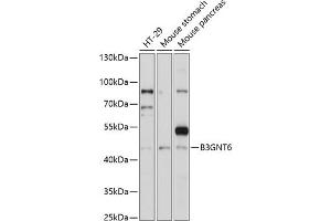 Western blot analysis of extracts of various cell lines, using B3GNT6 antibody (ABIN7271206) at 1:1000 dilution.