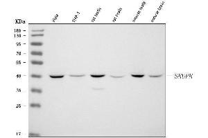 Western blot analysis of SNURPORTIN1/SNUPN using anti-SNURPORTIN1/SNUPN antibody (ABIN7599310).