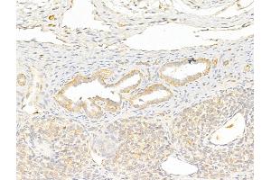 ABIN6255935 and ABIN6267312 at 1/100 staining Rat ovary tissue by IHC-P. (LCK anticorps  (pTyr505))