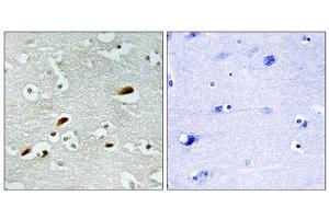 Immunohistochemistry analysis of paraffin-embedded human brain tissue, using TIP60 antibody. (KAT5 anticorps  (Internal Region))