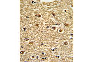 Immunohistochemistry (IHC) image for anti-Ets Variant 4 (ETV4) antibody (ABIN3002727)