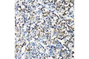 Immunohistochemistry of paraffin-embedded human tonsil using CD3E antibody.