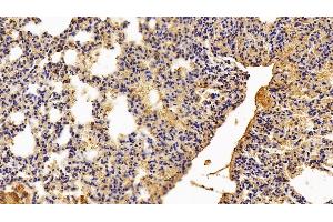 Detection of PKM2 in Mouse Lung Tissue using Polyclonal Antibody to Pyruvate kinase isozymes M2 (PKM2)