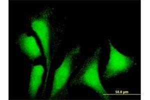 Immunofluorescence of purified MaxPab antibody to G3BP1 on HeLa cell.
