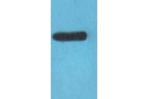 Western blot analysis on COLO205 cell lysate using Claudin 3 Antibody