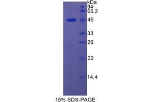 SDS-PAGE analysis of Rat Lipocalin 5 Protein. (LCN5 Protéine)
