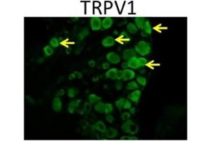 Expression of TRPV1 in mouse DRGsImmunohistochemical staining of mouse DRG sections using Anti-TRPV1 (VR1) Antibody (ABIN7043841, ABIN7043988 and ABIN7043989).