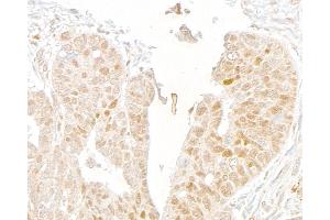 Immunohistochemistry (IHC) image for anti-Mediator Complex Subunit 1 (MED1) (C-Term) antibody (ABIN7453585) (MED1 anticorps  (C-Term))