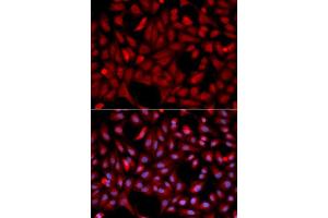 Immunofluorescence analysis of U2OS cell using SIAH1 antibody.
