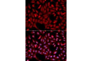 Immunofluorescence analysis of U2OS cell using SIAH1 antibody. (SIAH1 anticorps  (AA 1-313))
