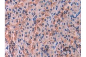 Detection of NOSTRIN in Rat Stomach Tissue using Polyclonal Antibody to Nitric Oxide Synthase Trafficker (NOSTRIN)