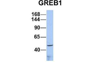 Host:  Rabbit  Target Name:  GREB1  Sample Type:  293T  Antibody Dilution:  1. (GREB1 anticorps  (Middle Region))