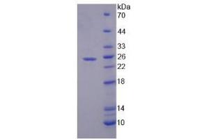 Image no. 1 for Secreted Phosphoprotein 2 (SPP2) (AA 30-211) protein (His tag) (ABIN4990666)