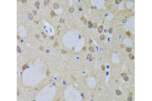 Immunohistochemistry of paraffin-embedded Mouse brain using YWHAZ Polyclonal Antibody at dilution of 1:100 (40x lens). (14-3-3 zeta anticorps)
