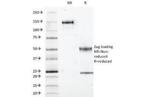 SDS-PAGE Analysis of Purified, BSA-Free S100 beta Antibody (clone S100B/1012).