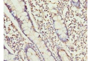 Immunohistochemistry of paraffin-embedded human small intestine tissue using ABIN7168462 at dilution of 1:100 (RUFY1 anticorps  (AA 439-708))