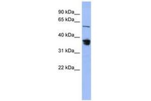 Image no. 1 for anti-RAD23 Homolog B (RAD23B) (AA 287-336) antibody (ABIN6744089) (RAD23B anticorps  (AA 287-336))