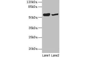 Western blot All lanes: NOSTRIN antibody at 6 μg/mL Lane 1: Mouse heart tissue Lane 2: Mouse brain tissue Secondary Goat polyclonal to rabbit IgG at 1/10000 dilution Predicted band size: 58, 55, 49, 65 kDa Observed band size: 58 kDa (NOSTRIN anticorps  (AA 1-322))
