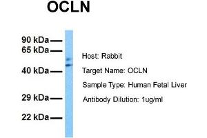 Host: Rabbit Target Name: OCLN Sample Tissue: Human Fetal Liver Antibody Dilution: 1.