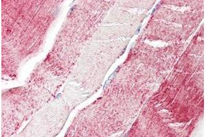 Image no. 2 for anti-Xylosyltransferase II (XYLT2) (AA 722-771) antibody (ABIN6749744)