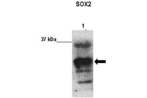 Sample Type:  Lane 1: 20 ug U87 lysate   Primary Antibody Dilution:  1:1000   Secondary Antibody:  Anti-rabbit-HRP   Secondary Antibody Dilution:  1:2000   Submitted by:  Ander Matheu Fernandez, Biodonostia Institute