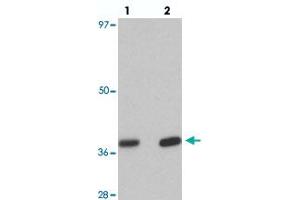 Western blot analysis of EI24 in rat liver tissue with EI24 polyclonal antibody  at (lane 1) 1 and (lane 2) 2 ug/mL. (EI24 anticorps  (C-Term))