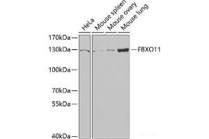 Western blot analysis of extracts of various cell lines using FBXO11 Polyclonal Antibody at dilution of 1:1000. (FBXO11 anticorps)