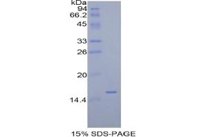 SDS-PAGE analysis of Human Diamine Oxidase Protein.