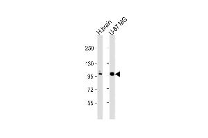 All lanes : Anti-ANO5 Antibody (C-term) at 1:1000 dilution Lane 1: human brain lysate Lane 2: U-87 MG whole cell lysate Lysates/proteins at 20 μg per lane. (Anoctamin 5 anticorps  (C-Term))