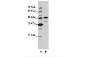 Image no. 2 for anti-Nucleolar Protein 4 (NOL4) (AA 239-288) antibody (ABIN6736202) (NOL4 anticorps  (AA 239-288))