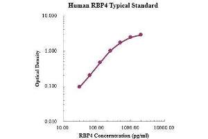 ELISA image for Retinol Binding Protein 4, Plasma (RBP4) ELISA Kit (ABIN3198609) (RBP4 Kit ELISA)