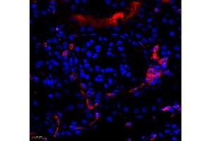 Immunofluorescence of paraffin embedded rat kidney using MTND5 (ABIN7074659) at dilution of 1: 400 (450x lens)