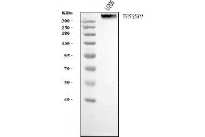 Western blot analysis of 53BP1/TP53BP1 using anti-53BP1/TP53BP1 antibody (ABIN7599869). (TP53BP1 anticorps  (AA 1239-1972))